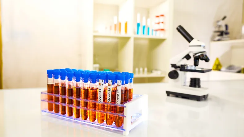 muestras en tubos de ensayo para el coronavirus.