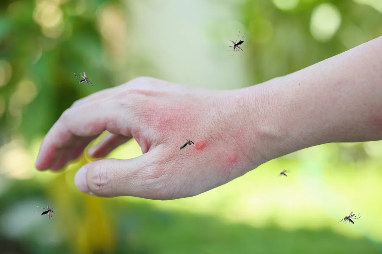 La picadura de mosquito en la mano de un adulto provoca sarpullido y alergia con mancha roja.